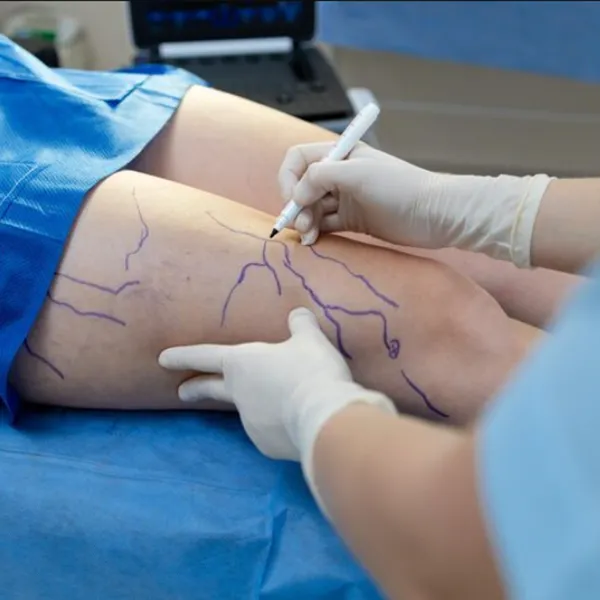 Cirugía Vascular en Consultorios Aldama, Coghlan